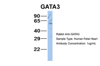 GATA3 Rabbit Polyclonal Antibody