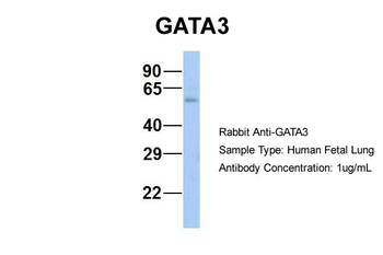 GATA3 Rabbit Polyclonal Antibody