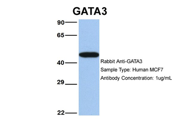 GATA3 Rabbit Polyclonal Antibody