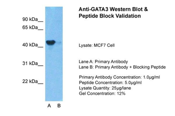 GATA3 Rabbit Polyclonal Antibody