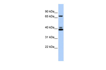 GATA6 Rabbit Polyclonal Antibody