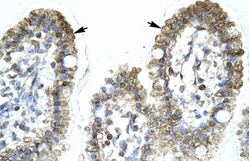 MYCBP Rabbit Polyclonal Antibody
