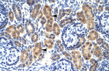 MYCBP Rabbit Polyclonal Antibody