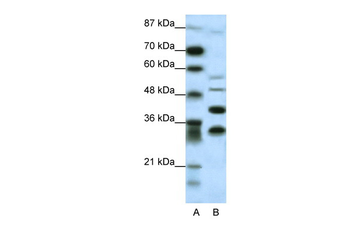 GFI1 Rabbit Polyclonal Antibody