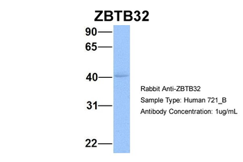 ZBTB32 Rabbit Polyclonal Antibody