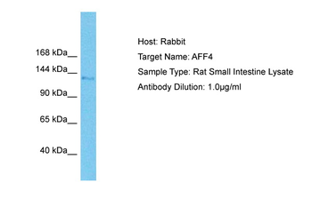 Aff4 Rabbit Polyclonal Antibody