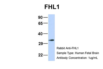FHL1 Rabbit Polyclonal Antibody