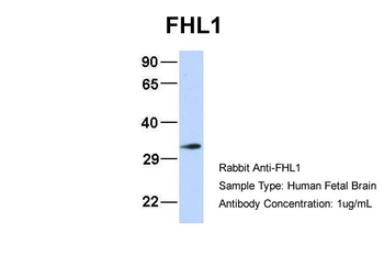 FHL1 Rabbit Polyclonal Antibody
