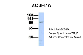 ZC3H7A Rabbit Polyclonal Antibody