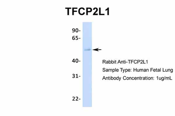 TFCP2L1 Rabbit Polyclonal Antibody