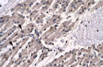 TFCP2L1 Rabbit Polyclonal Antibody