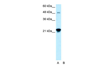 LASS2 Rabbit Polyclonal Antibody