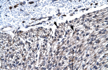 HCLS1 Rabbit Polyclonal Antibody