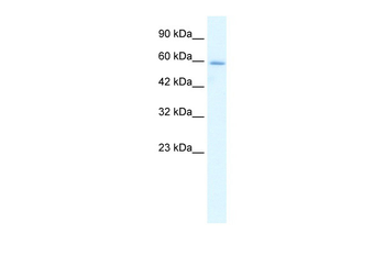 HCLS1 Rabbit Polyclonal Antibody