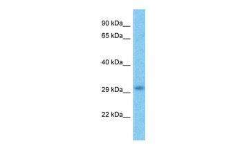 HDAC1 Rabbit Polyclonal Antibody