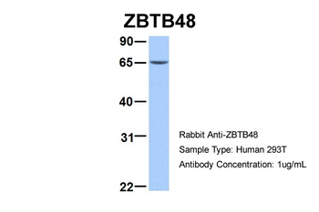ZBTB48 Rabbit Polyclonal Antibody