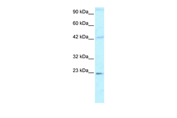 HMGB2 Rabbit Polyclonal Antibody