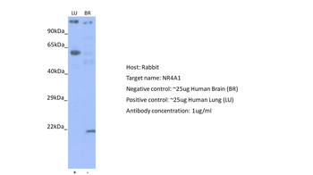 NR4A1 Rabbit Polyclonal Antibody