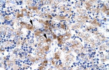 NR4A1 Rabbit Polyclonal Antibody