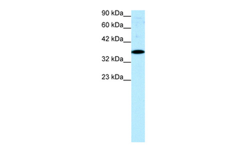 NR4A1 Rabbit Polyclonal Antibody