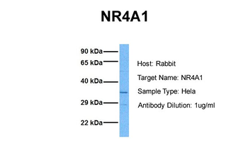 NR4A1 Rabbit Polyclonal Antibody