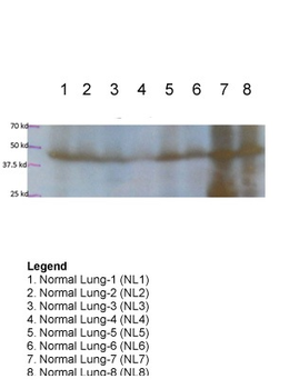 FOXA2 Rabbit Polyclonal Antibody