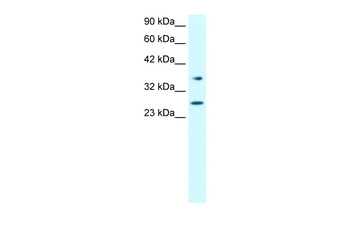 FOXA3 Rabbit Polyclonal Antibody