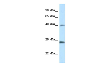 Hoxb9 Rabbit Polyclonal Antibody