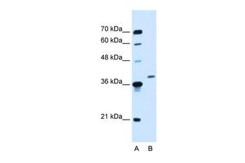 HOXD11 Rabbit Polyclonal Antibody