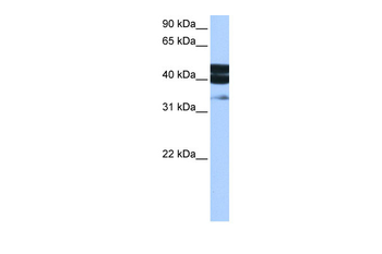 SMAD1 Rabbit Polyclonal Antibody