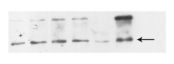 SMAD4 Rabbit Polyclonal Antibody