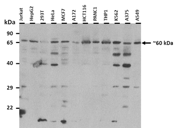 SMAD4 Rabbit Polyclonal Antibody