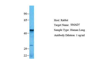 SMAD7 Rabbit Polyclonal Antibody