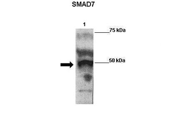 SMAD7 Rabbit Polyclonal Antibody
