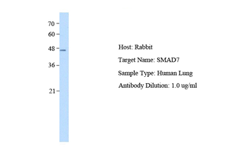 SMAD7 Rabbit Polyclonal Antibody