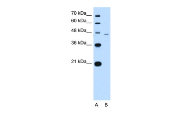 SMAD7 Rabbit Polyclonal Antibody
