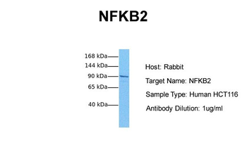 NFKB2 Rabbit Polyclonal Antibody