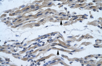 NFKB2 Rabbit Polyclonal Antibody