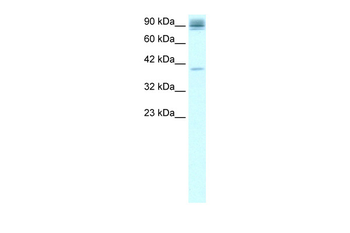 NFKB2 Rabbit Polyclonal Antibody