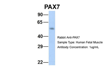 PAX7 Rabbit Polyclonal Antibody