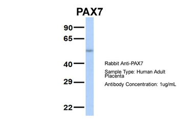 PAX7 Rabbit Polyclonal Antibody