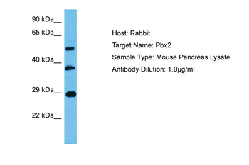 PBX2 Rabbit Polyclonal Antibody
