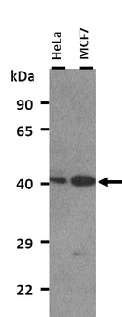 NR2E1 Rabbit Polyclonal Antibody