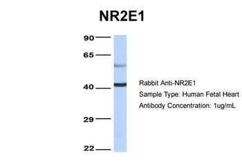 NR2E1 Rabbit Polyclonal Antibody