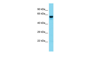 FOXO6 Rabbit Polyclonal Antibody
