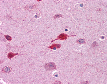 WNT5A Rabbit Polyclonal Antibody