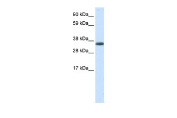 ERCC8 Rabbit Polyclonal Antibody
