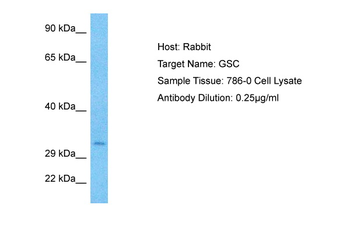 GSC Rabbit Polyclonal Antibody