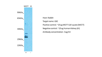 GSC Rabbit Polyclonal Antibody