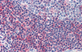 GSC Rabbit Polyclonal Antibody